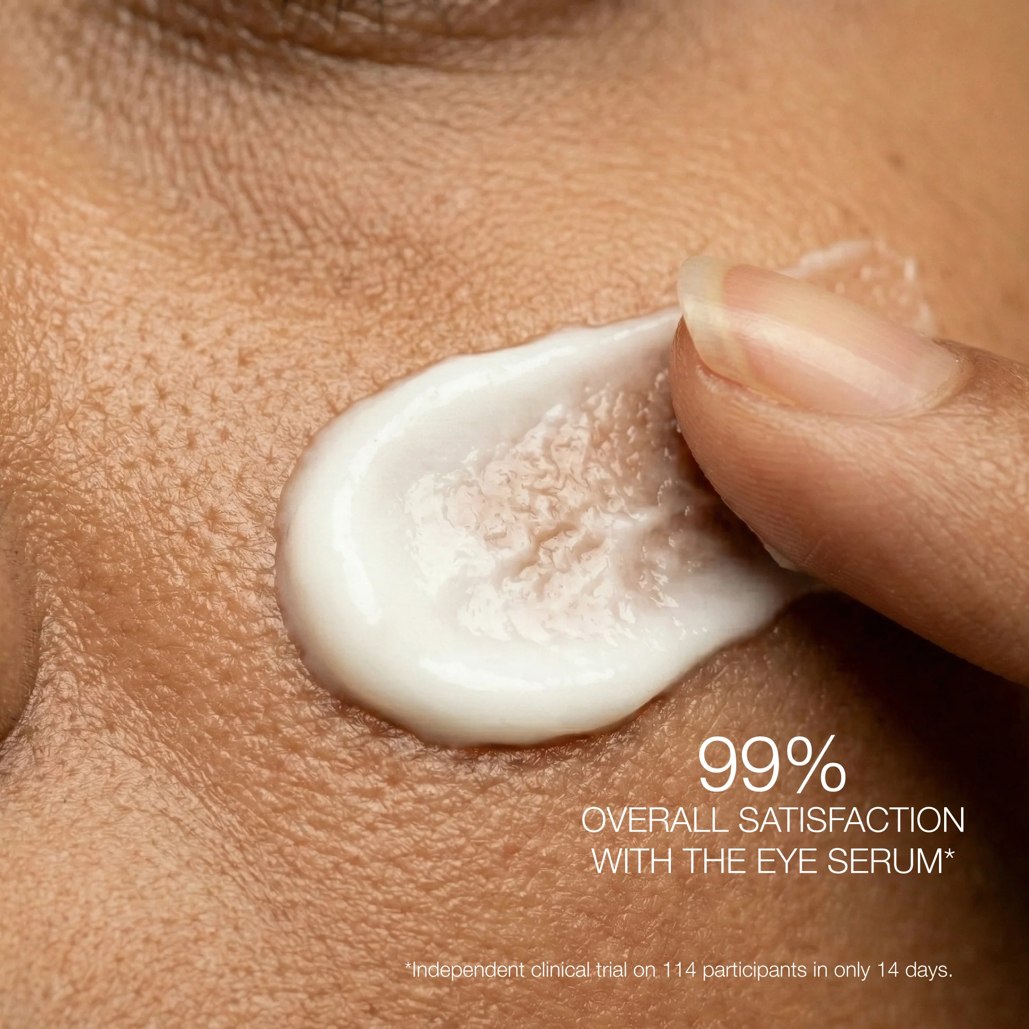 [Hyaluronic Acid + R.N.A.] - De-puffing & Dark Circles Relief Eye Serum - Image 3